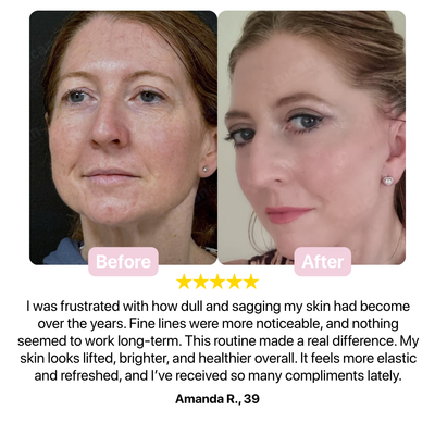 Melaxin Lift Set – Intensive Firming and Brightening Routine