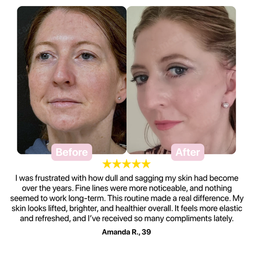 Melaxin Lift Set – Intensive Firming and Brightening Routine